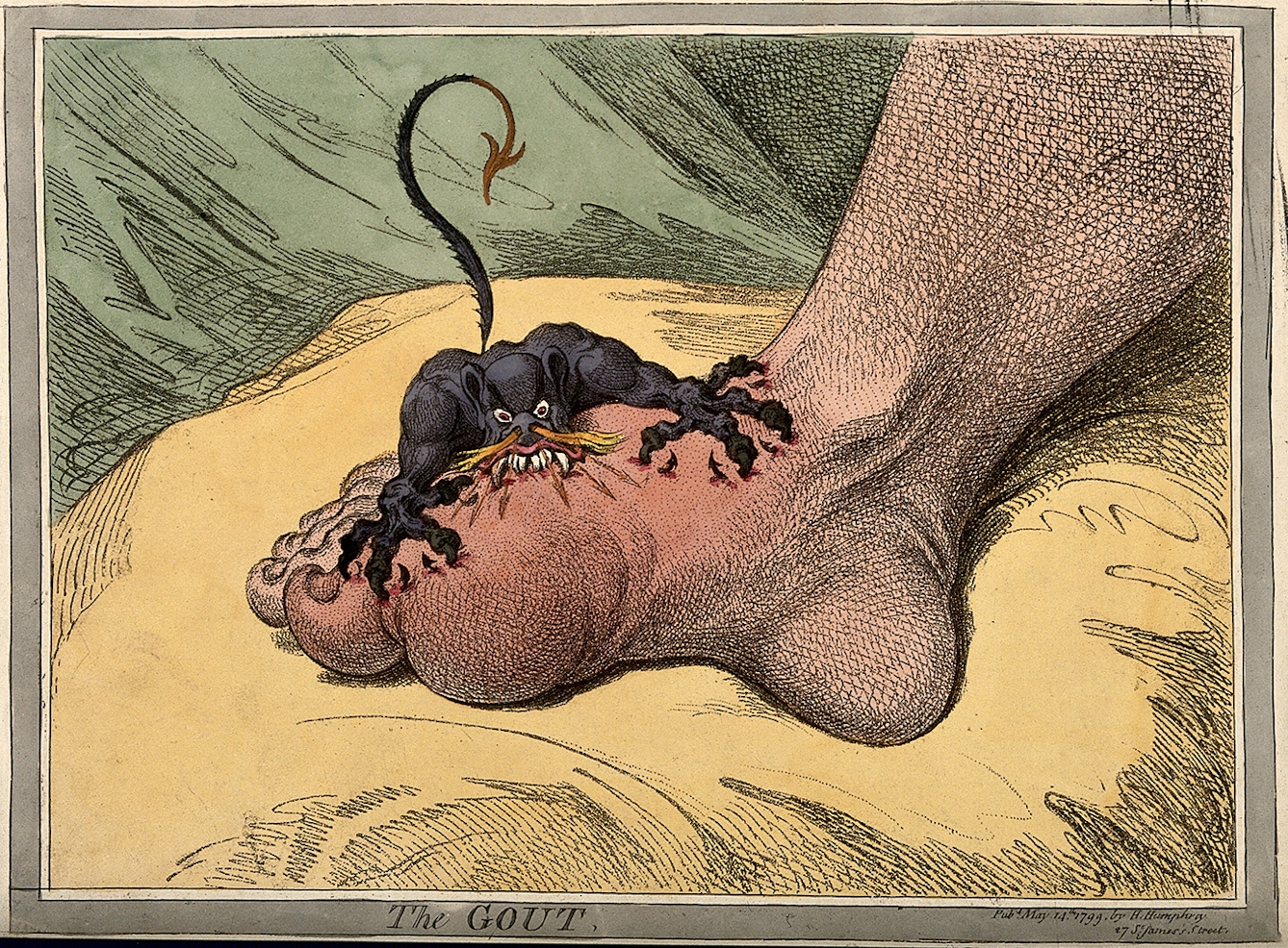 A swollen and reddened foot rests on a plush cushion. A small black devil, with sharp claws and a forked tail, bites into the most swollen part of the foot with sharp pointed teeth and flames coming from it's nose. 