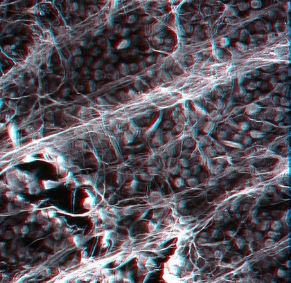 Surface of retina showing glial cells - 3D
